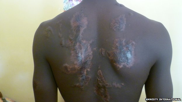 Nigeria Ã¢â‚¬Ëœuses torture officers to extract confessionsÃ¢â‚¬â„¢